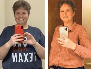 Patient Before After Image