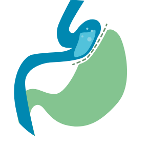 Gastric Bypass icon