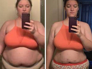 Patient Before After Image