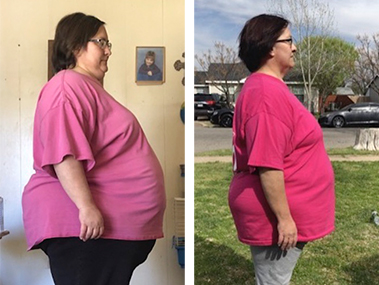 Patient Before After Image