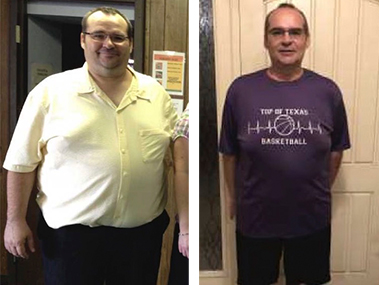 Patient Before After Image