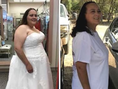 Patient Before After Image