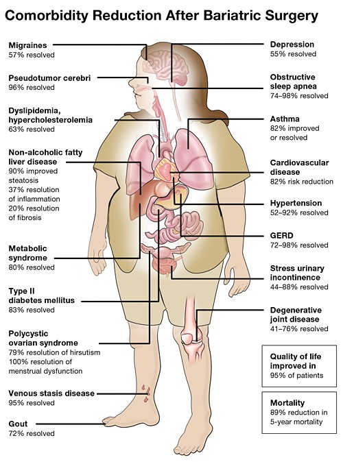 comorbidity chart