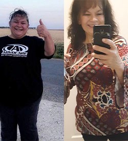 Palmira's weight loss transformation