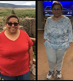 Annette's weight loss transformation
