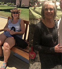 Sandy's weight loss transformation