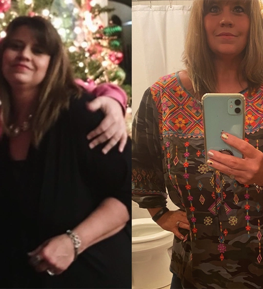 Krisit's weight loss transformation